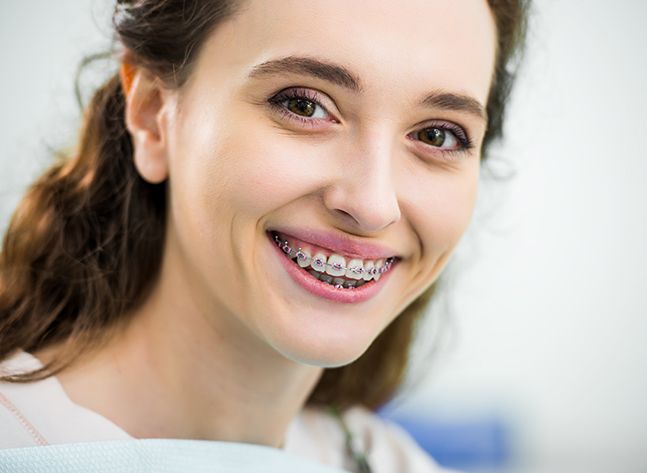 a patient with braces smilinga 3D illustration of an underbite