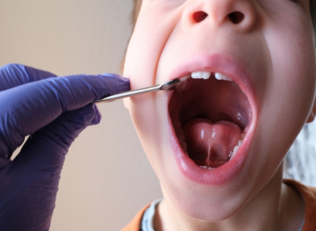 a boy with a tongue tie