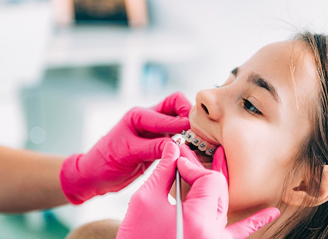 an orthodontist putting braces on a teen