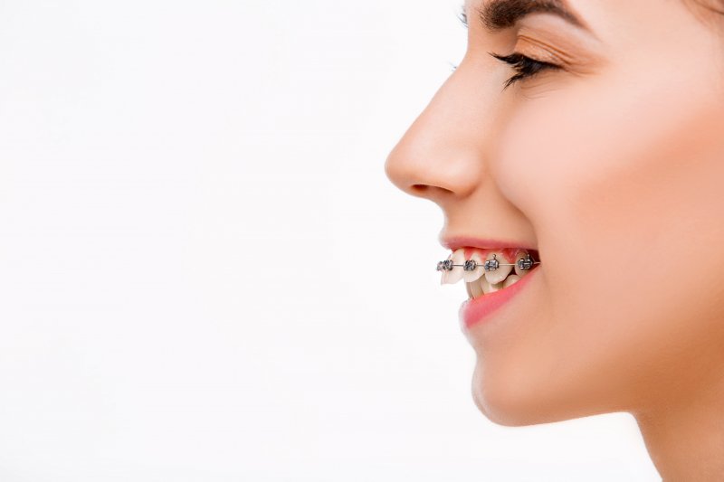 A patient having their overbite corrected with braces